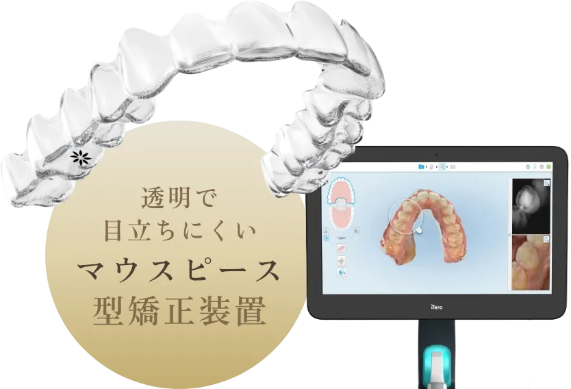 錦糸町の歯医者・歯科｜ホワイトデンタルクリニック錦糸町の透明で目立ちにくいマウスピース型矯正装置