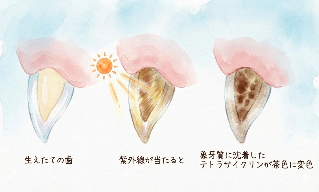 テトラサイクリン歯は「レベル別」に治療を考えます