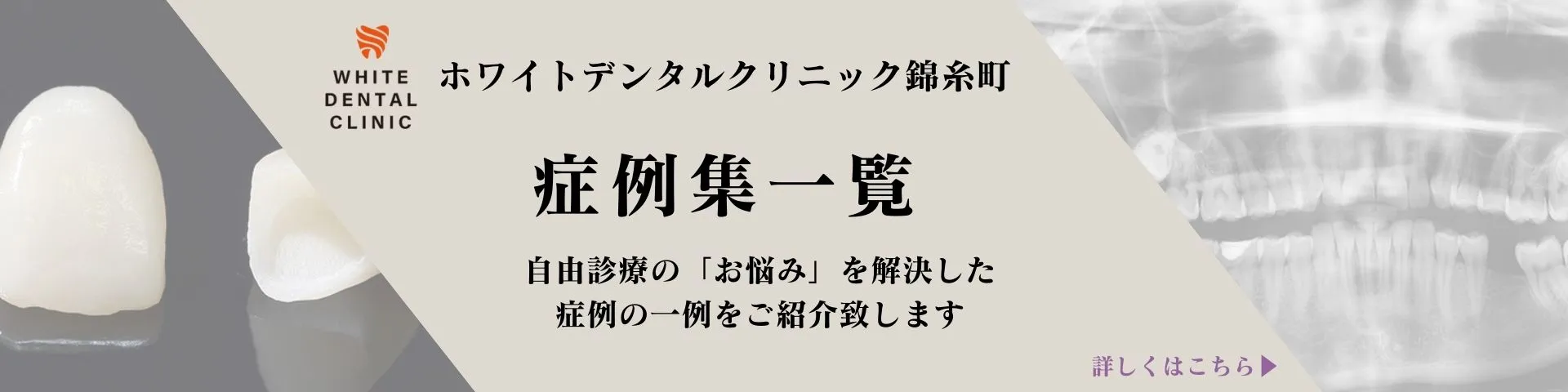 錦糸町の歯医者・歯科｜ホワイトデンタルニック錦糸町の症例
