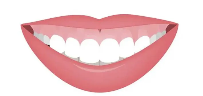 H3,3mm以上が目安？ガミースマイルの定義