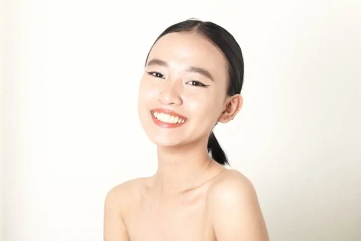 軽度な隙間や形が原因の方へ：ダイレクトボンディング