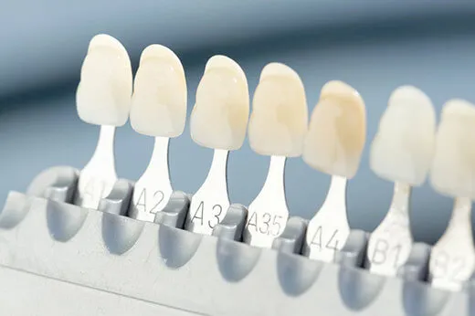 歯科医院で行うホワイトニング