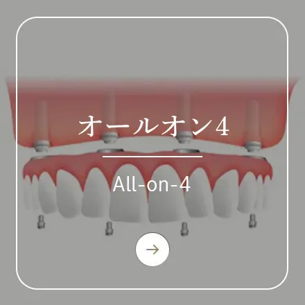 錦糸町の歯医者・歯科｜ホワイトデンタルクリニック錦糸町のオールオン4