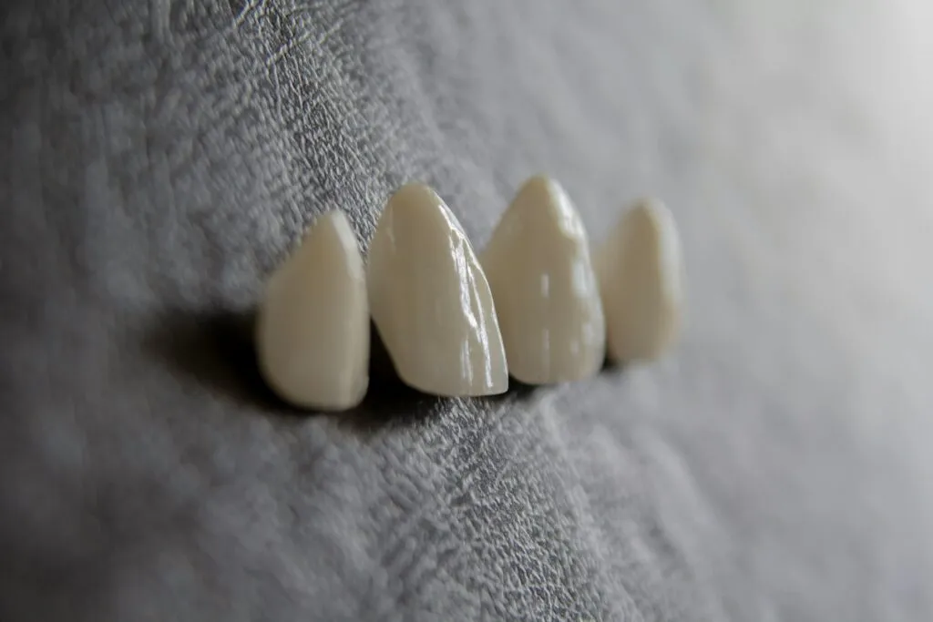 仮歯・差し歯が取れた!やってはいけないNG行動と原因・応急処置|墨田区・錦糸町の歯医者ならホワイトデンタルクリニック錦糸町